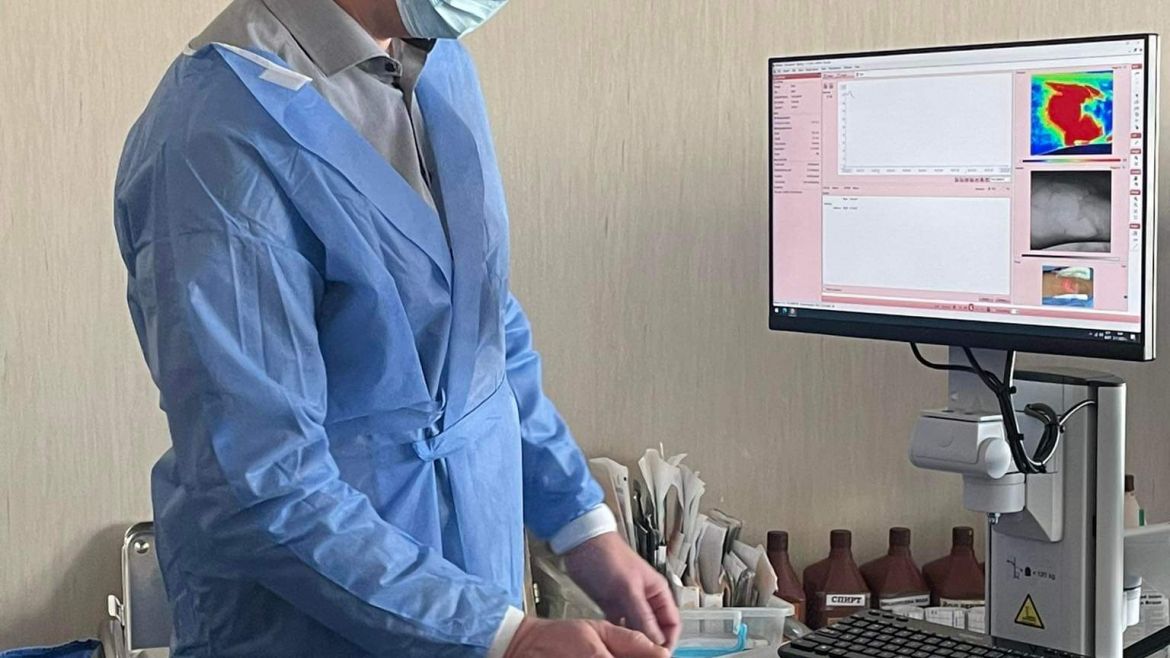 Уникален скенер за кожа получи университетската спешна болница „Пирогов”