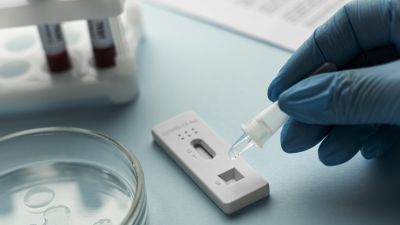 10 лева струват бързите антигенни тестове в УМБАЛСМ „Н.И. Пирогов“  от 25.10.2021 г.